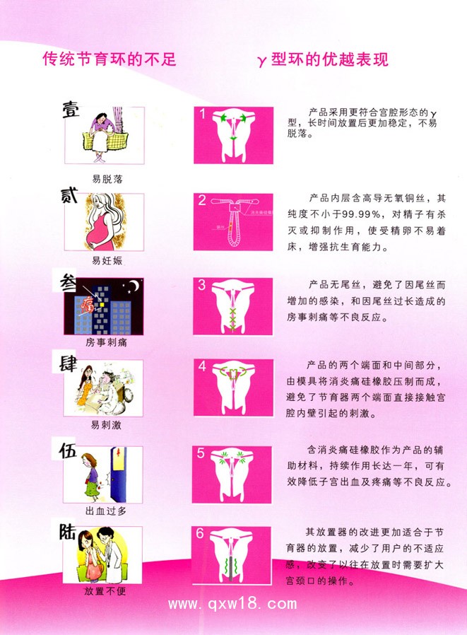 γ型含銅含吲哚美辛宮內(nèi)節(jié)育器