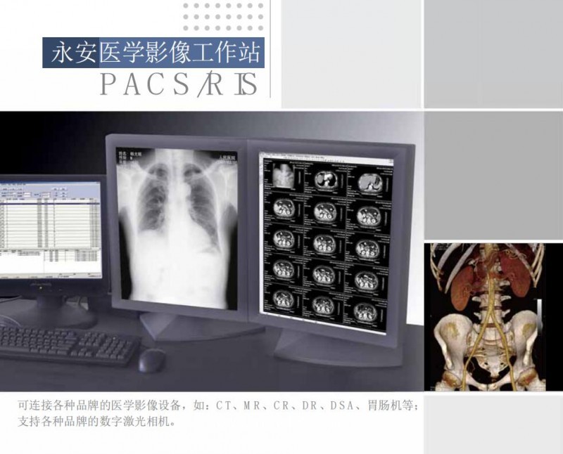 影像工作站（超聲、DR、CT、核磁）軟件廠家