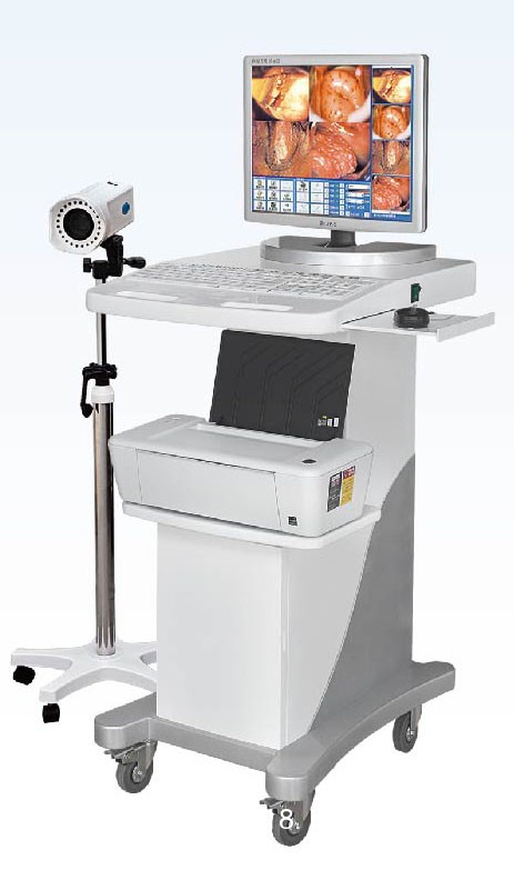 江蘇億康直供全EK-6000C數(shù)字高清數(shù)碼電子陰道鏡可代理