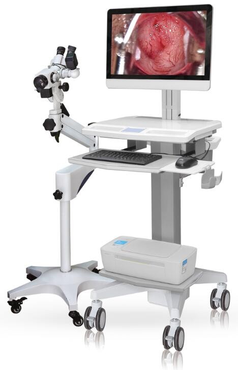 江蘇億康直供全EK-6000C數(shù)字高清數(shù)碼電子陰道鏡可代理