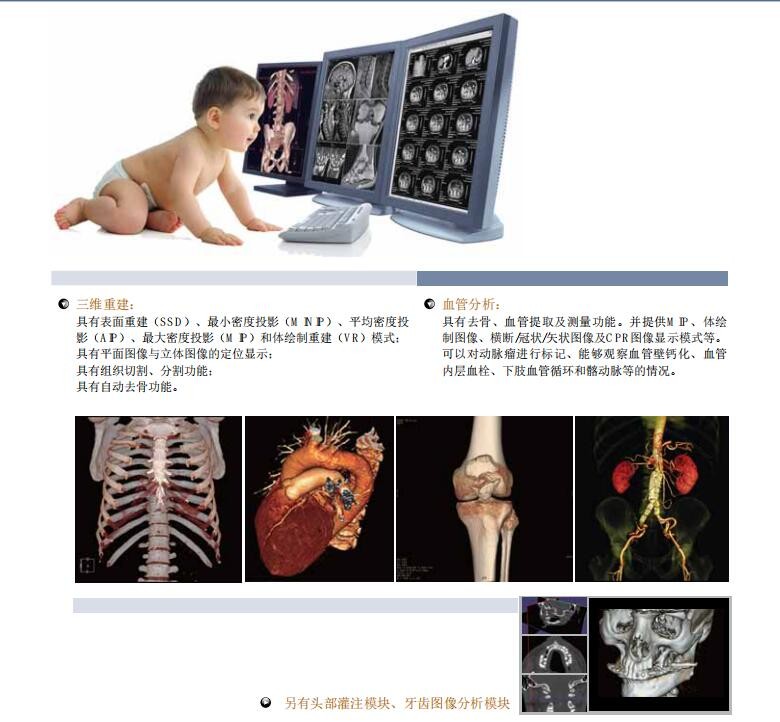 放射科影像工作站軟件/永安科技/廠家