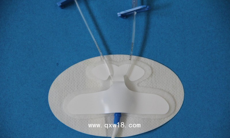 體表導(dǎo)管固定裝置