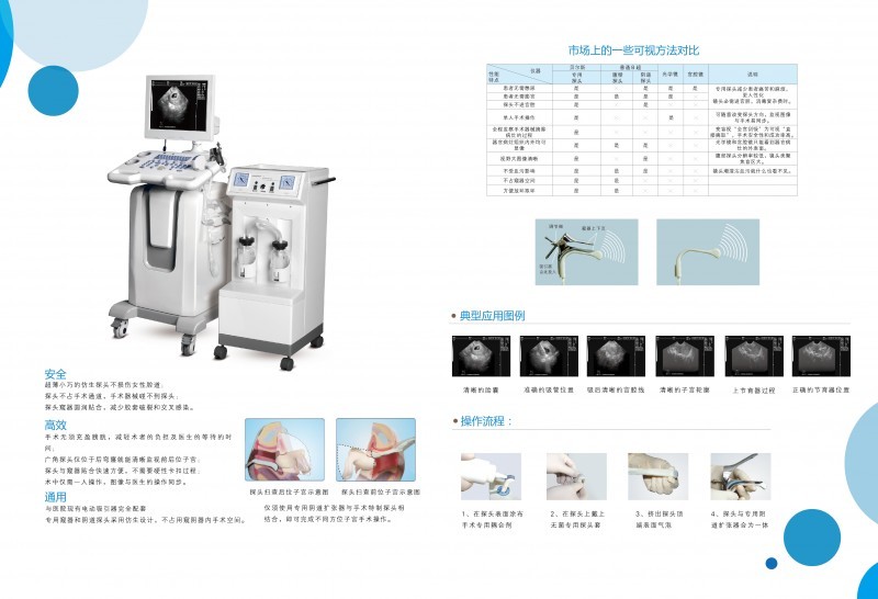 全數(shù)字超聲診斷系統(tǒng)