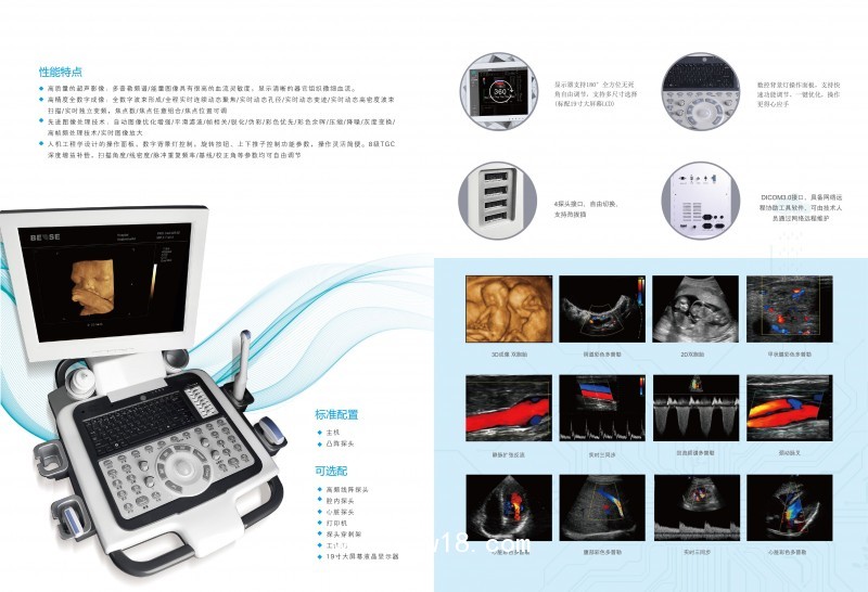 全數(shù)字彩色多普勒超聲診斷儀