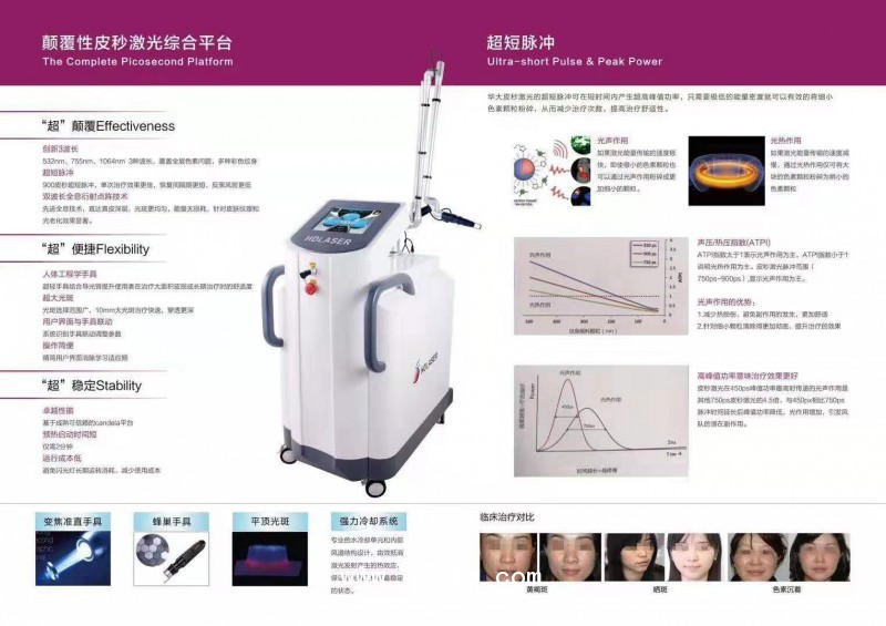 皮秒激光祛斑祛痣洗紋身