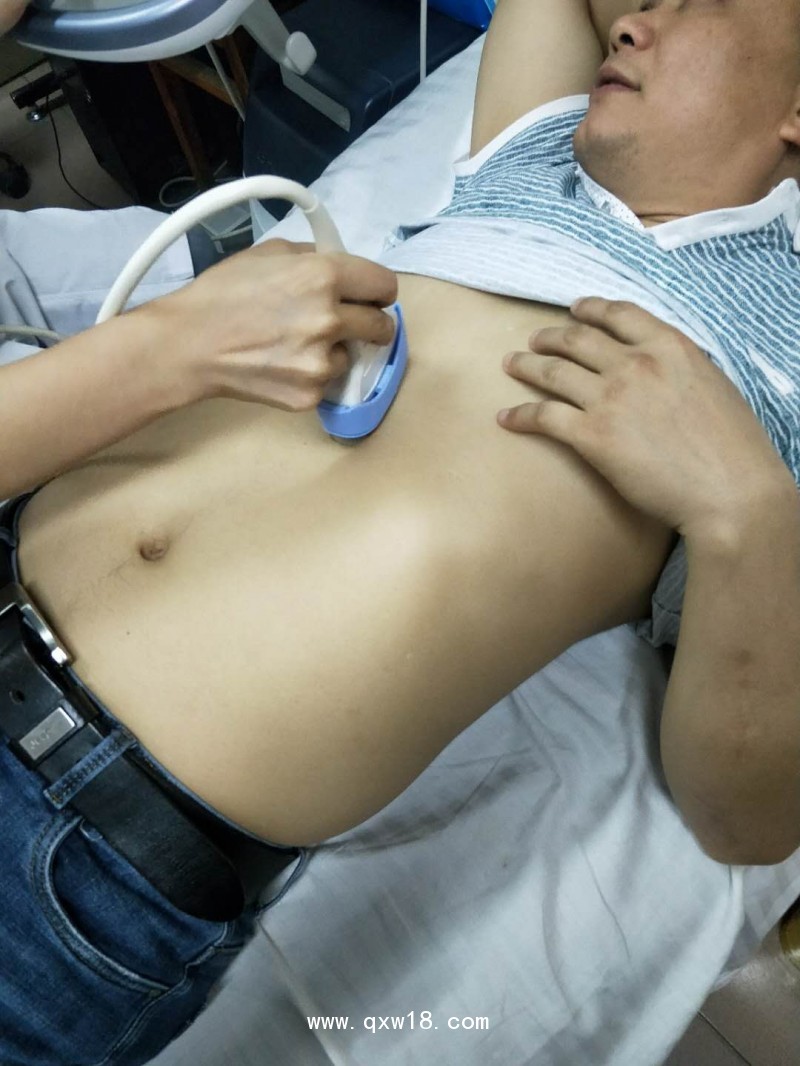 醫(yī)用超聲耦合貼片（B超耦合卡膜）