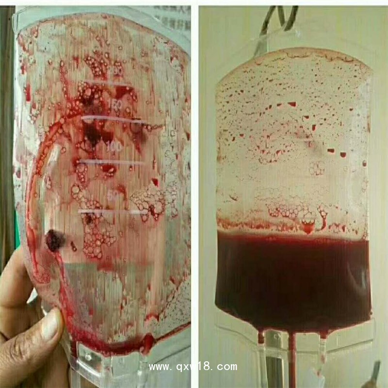 血袋、大自血血袋三大廠家南京賽爾金、蘇州萊仕、四川南格爾