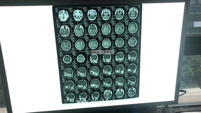 奧格西熱敏膠片（可提供自助取片機(jī)））