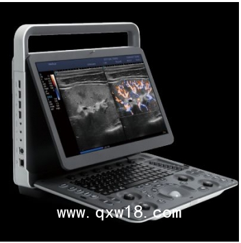 開立E1EXP便攜式彩超