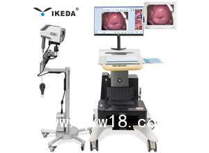 數碼電子陰道鏡 雙屏數碼電子陰道鏡