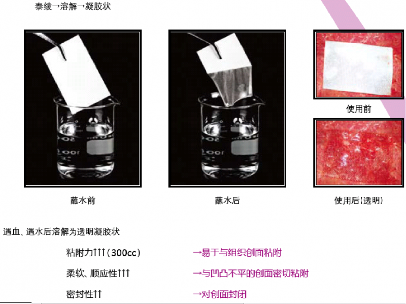 可吸收止血紗布