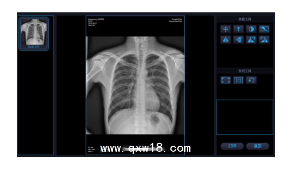 國(guó)內(nèi)品牌 移動(dòng)式X光機(jī) X射線拍片機(jī)