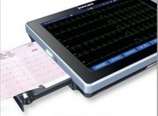 導(dǎo)聯(lián)自動分析心電圖機