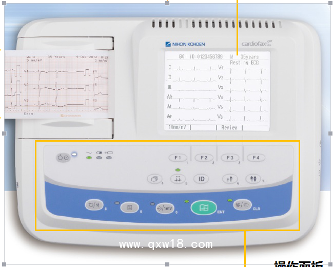 上海光電三道心電圖機專業(yè)分析系統(tǒng)