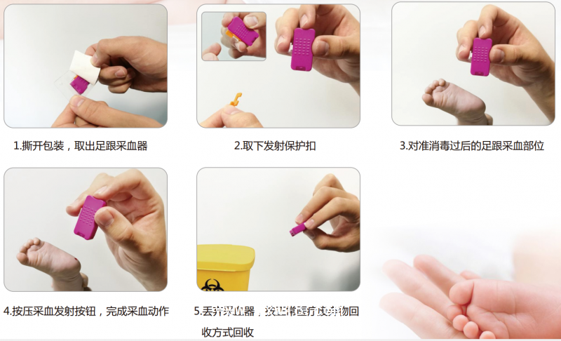 新生兒足跟采血器