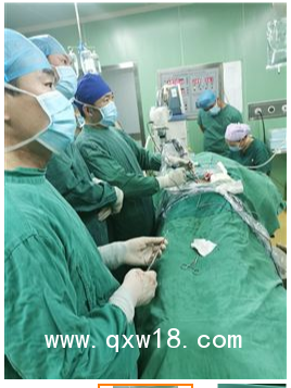 UBE器械包，UBE融合器械包，UBE大直徑消融電極