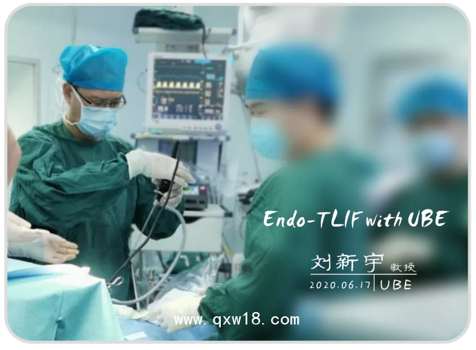 UBE器械包，UBE融合器械包，UBE大直徑消融電極