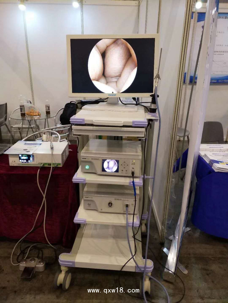 椎間盤摘除術(shù) 大視野內(nèi)窺鏡 關(guān)節(jié)鏡