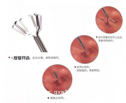 萬瑪醫(yī)療現(xiàn)貨提供唯德康一次性使用止血夾裝置