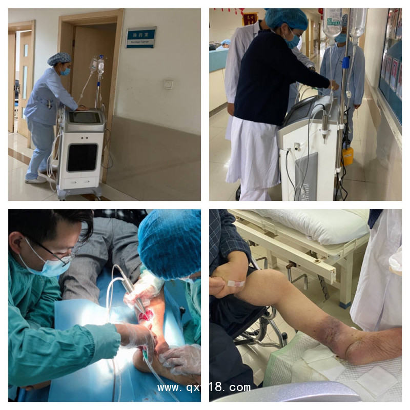 外傷傷口清洗設備