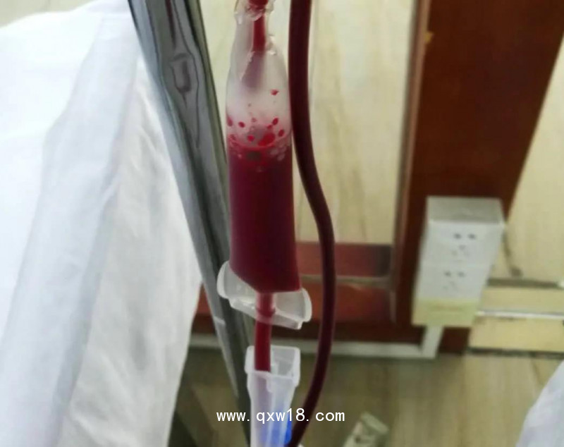 免疫三氧自體血療法心腦血管疾病的治療和預防