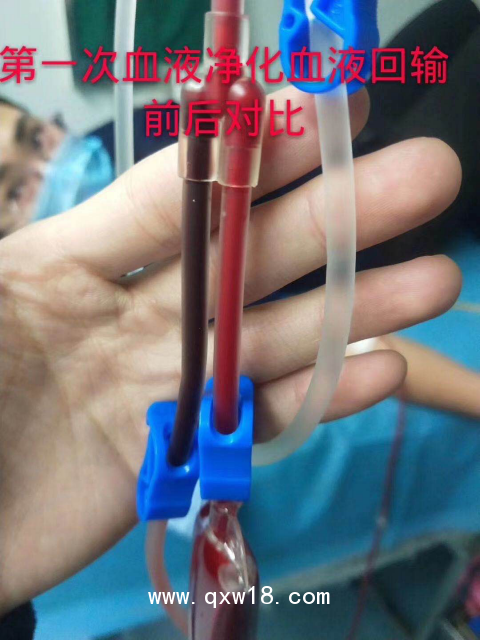 醫(yī)用臭氧治療儀便攜式三類臭氧機(jī)