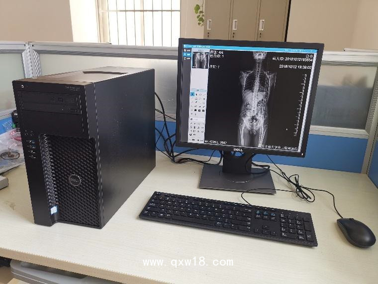 骨科拼接床DR長骨影像拼接