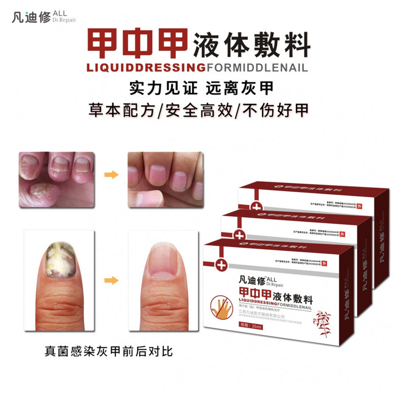 甲中甲液體敷料亮甲廠家灰指甲專用盒OEM貼牌代加工