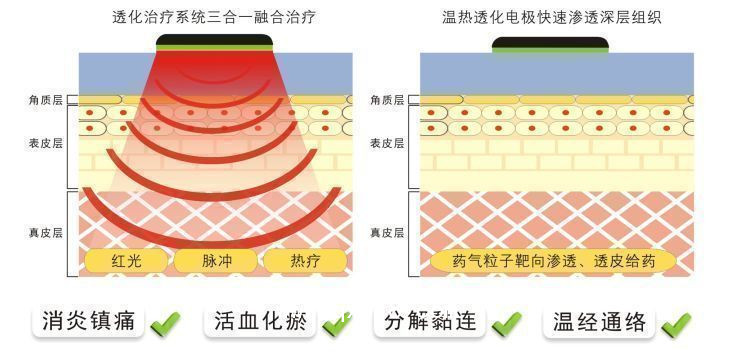 中頻理療儀 康復科甲類醫(yī)保新農合100%報銷  觸摸屏操作