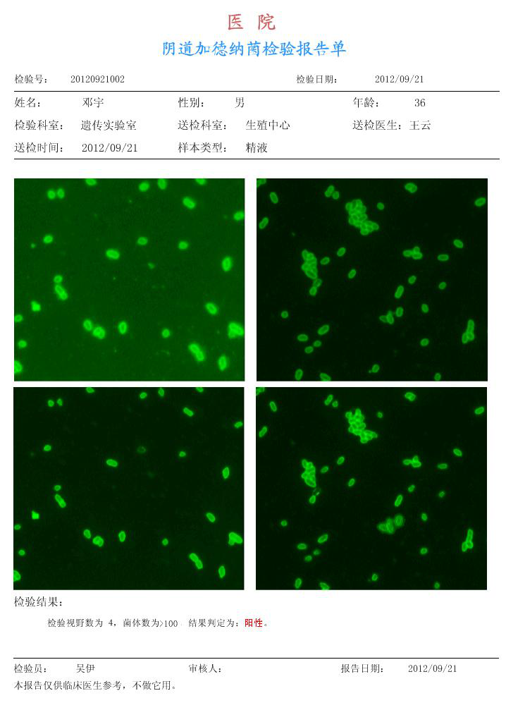 陰道微生物免疫熒光染色液