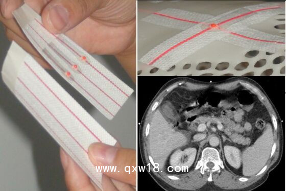 醫(yī)學(xué)圖像體外定位貼（MK-RT型，MK-CT型）