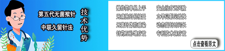 無(wú)菌電磁導(dǎo)電撳針