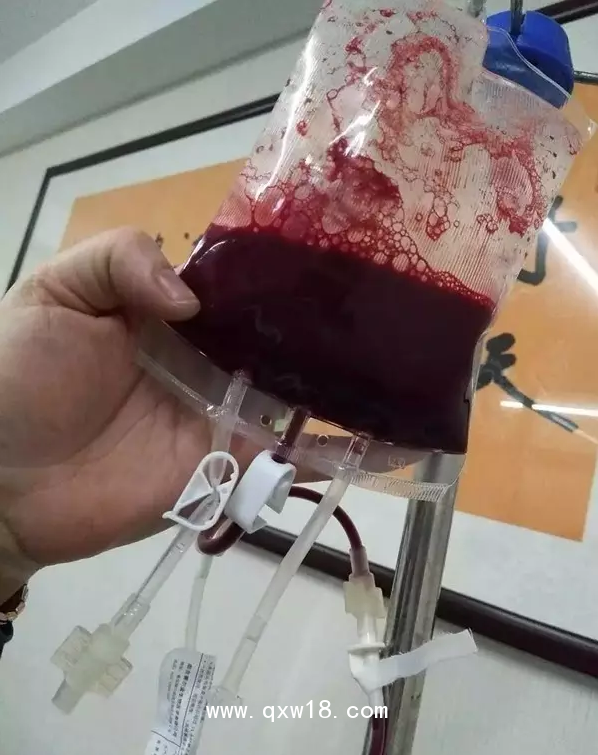 一次性大自血血袋，一次性輸血器，醫(yī)用臭氧儀等耗材產(chǎn)品批發(fā)