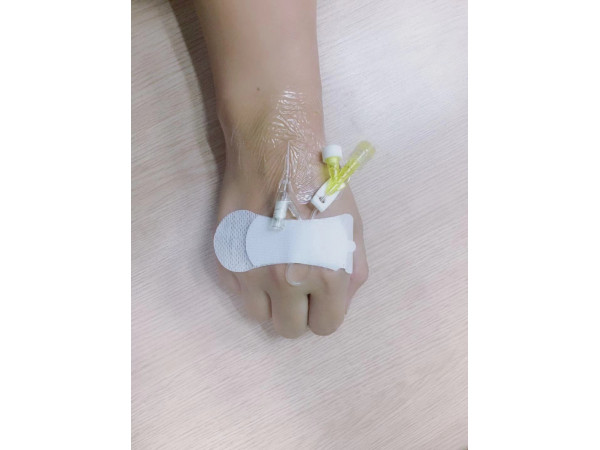 一次性使用無菌敷貼A5