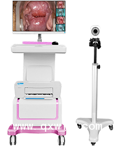 數(shù)碼電子陰道鏡