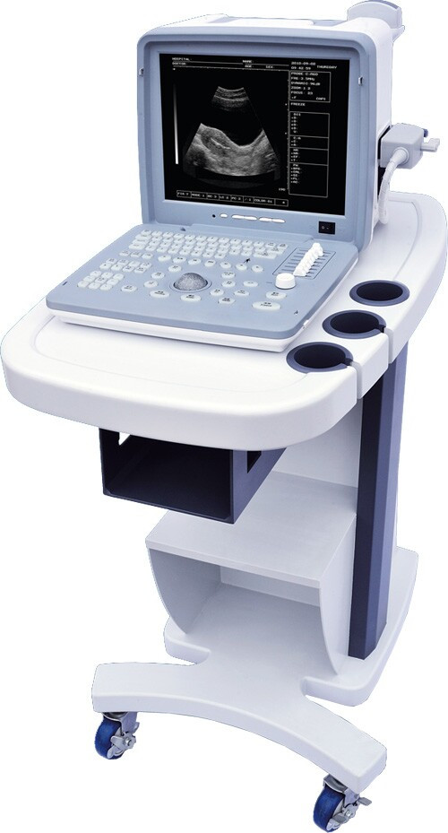 全數(shù)字超聲顯像診斷儀廠家直銷便攜式黑白B超機(jī)