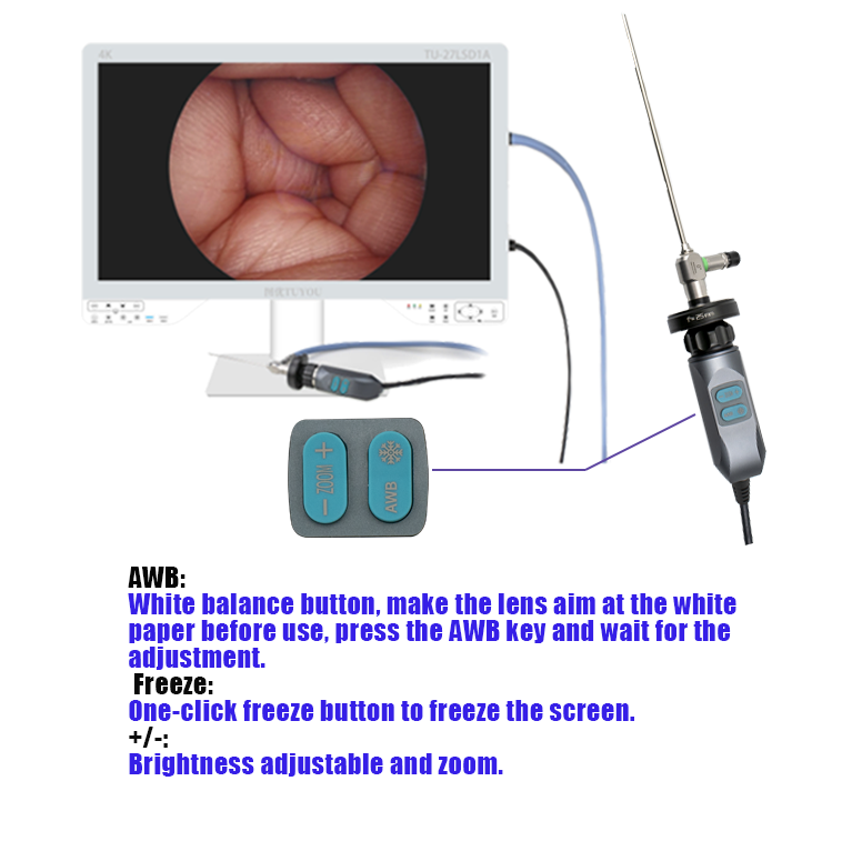 內(nèi)窺鏡光源視頻錄像一體化成像系統(tǒng)TU-27LSD2B