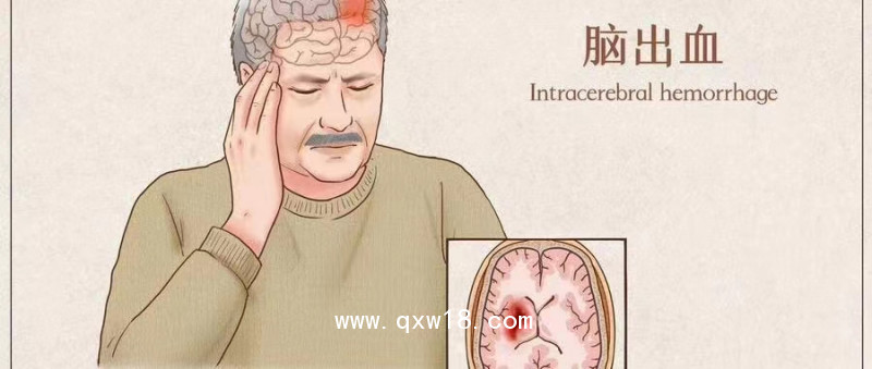 初鴻腦功能刺激儀 失眠治療儀BW-6911醫(yī)用豪華款