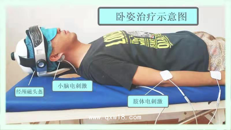 初鴻腦循環(huán)功能障礙治療儀BW-6911 腦功能治療儀 腦循環(huán)