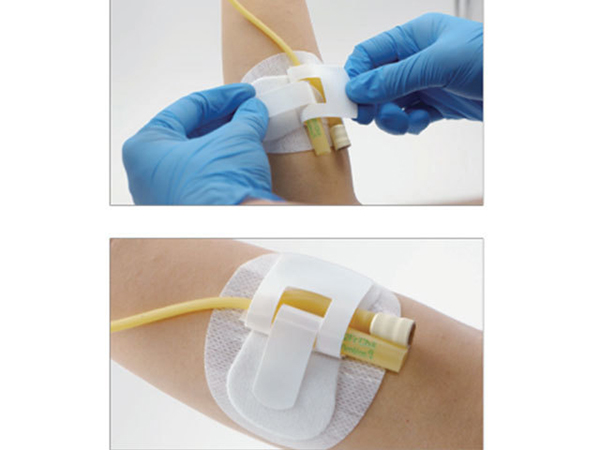一次性使用無菌敷貼（導管固定貼）