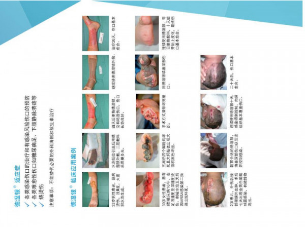 保赫曼敷料德濕銀