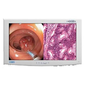 NDS醫(yī)療液晶監(jiān)視器