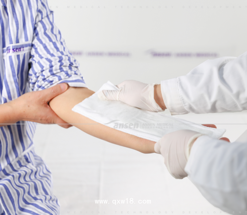 高分子夾板——代替?zhèn)鹘y(tǒng)石膏