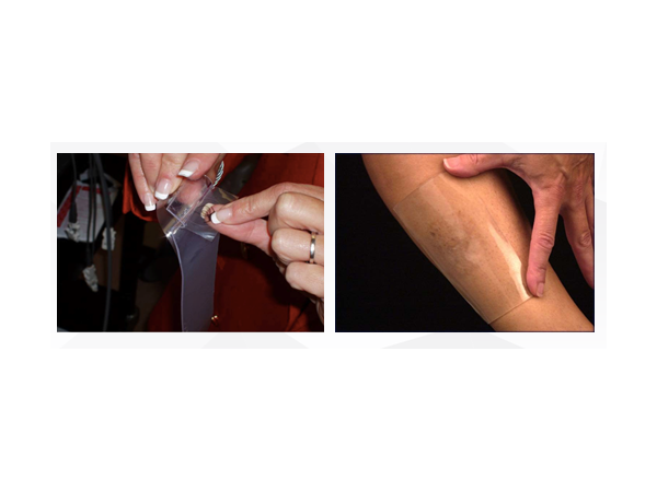 絲芙美疤痕敷料