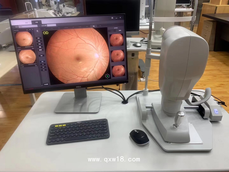 SW-8800免散瞳數(shù)碼眼底照相機