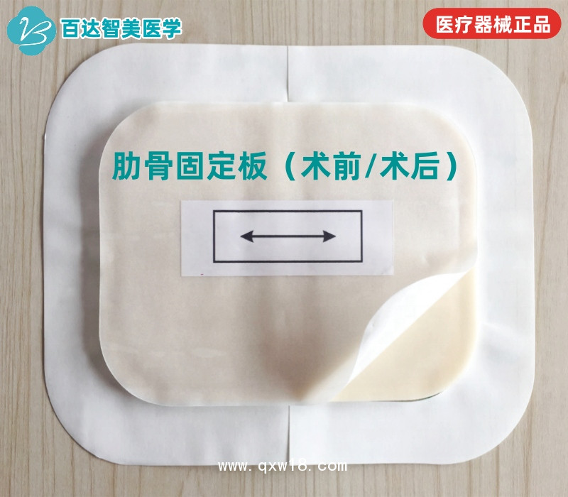 肋骨固定板/心胸外科術后護板/可塑形記憶合金夾板百達智美醫(yī)學