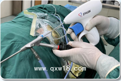 一次性纖維環(huán)縫合器工作原理