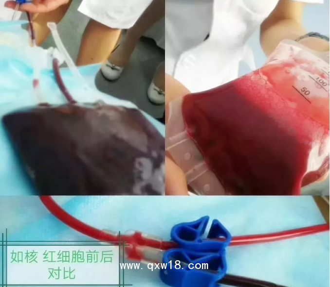 進口醫(yī)用臭氧治療儀 國產(chǎn)醫(yī)用臭氧治療儀