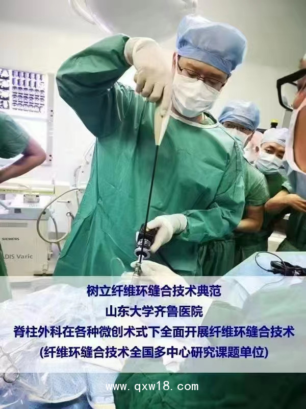 國產(chǎn)骨科高值耗材非帶量一次性纖維環(huán)縫合器