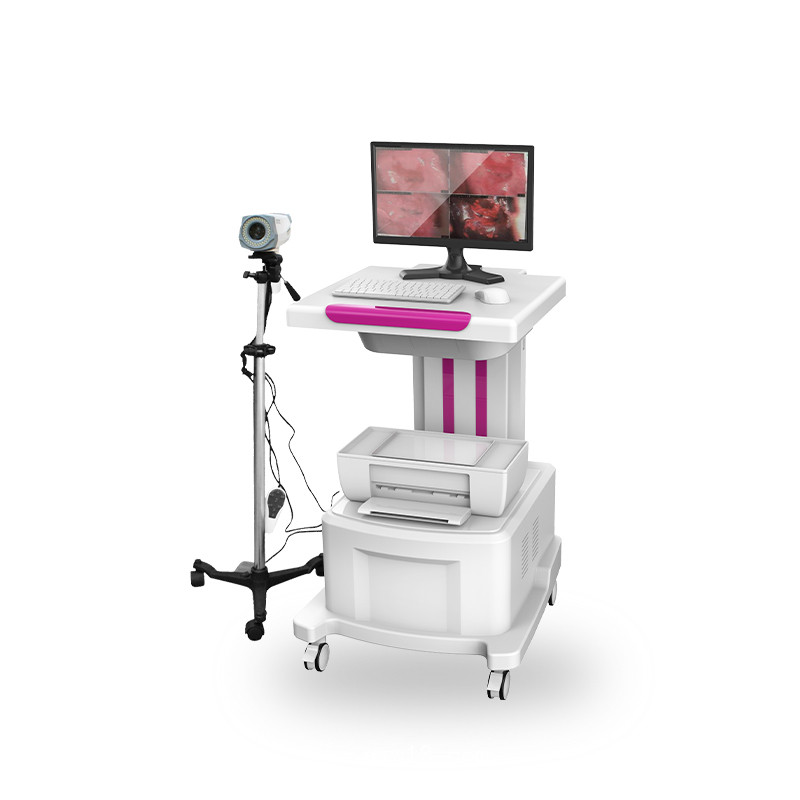 電子數(shù)碼陰道鏡  陰道鏡廠家  電子陰道鏡